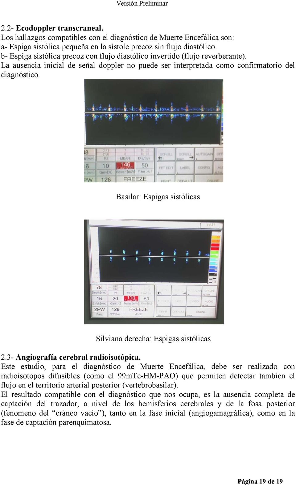 Basilar: Espigas sistólicas Silviana derecha: Espigas sistólicas 2.3- Angiografía cerebral radioisotópica.