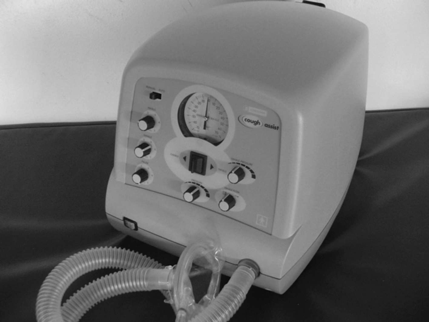 Evaluación respiratoria de la enfermedad neuromuscular en niños 9 Figura 4.- Expectoración asistida mediante insuflador-exuflador mecánico (Cough assist).