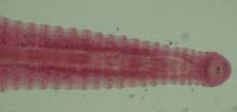 Clase Hirudinea Ventosa Anterior & posterior Sin setas Mayoría vive en agua dulce Alimentación Invertebrados Fluidos corporales Sangre C.