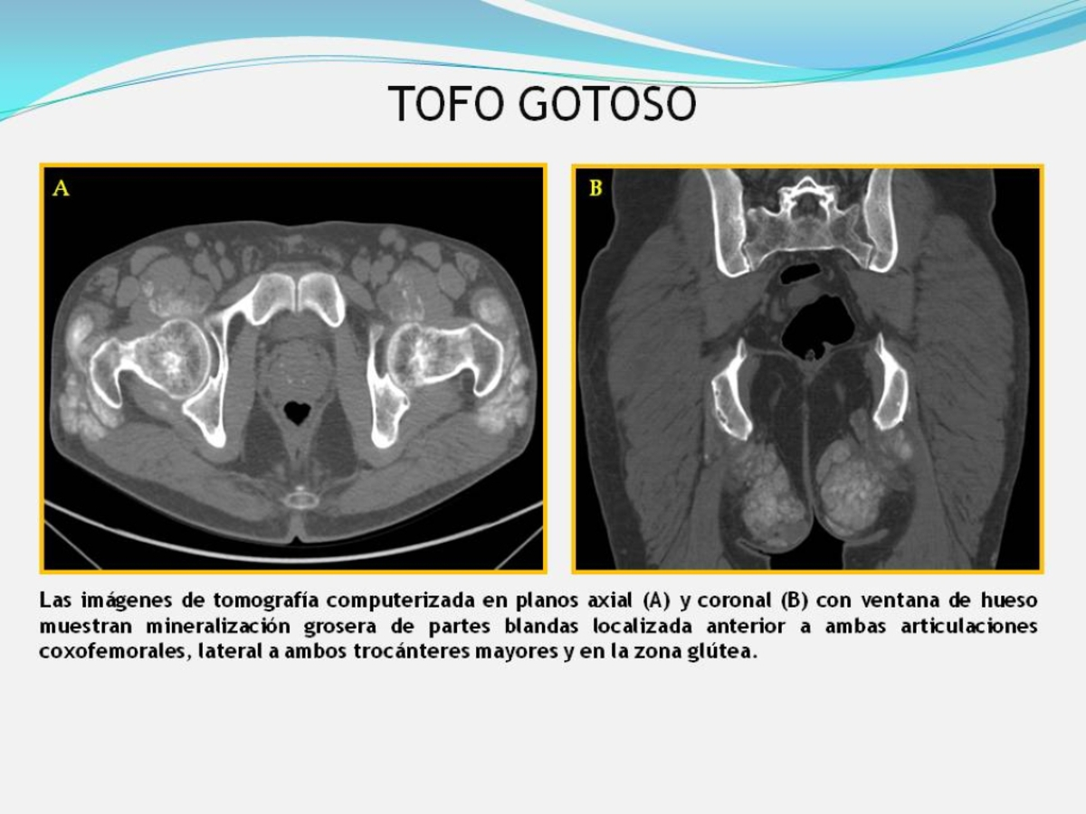 Fig. 17: TOFO