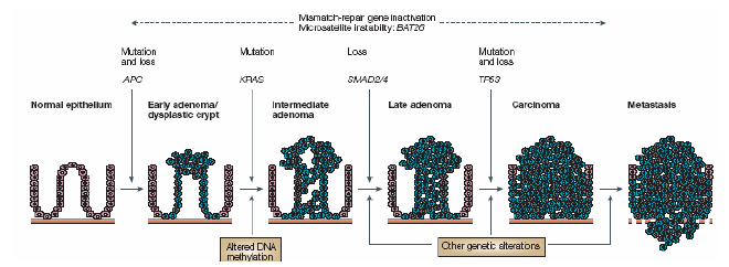 .. Inactivació del gen reparador de mismatch Inestabilitat microsatèlits: BAT26 Mutació Mutació Pèrdua Mutació i pèrdua i pèrdua. APC XRAS SMAD2/4 TP53 Epiteli normal Adenoma 