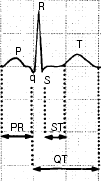 Intervalo QT Se extiende desde el inicio de la onda Q al final de la onda T. Varia con la frecuencia cardiaca.