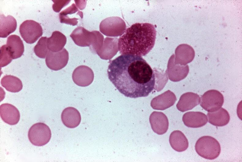 Tejido conjuntivo común: Células inmigrantes Las células cianófilas de Ramón y Cajal, conocidas como células plasmáticas o plasmocitos, derivan de una variedad de