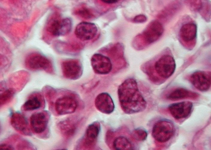 Tejido conjuntivo común: Células inmigrantes Este corte muestra la lámina propia del intestino