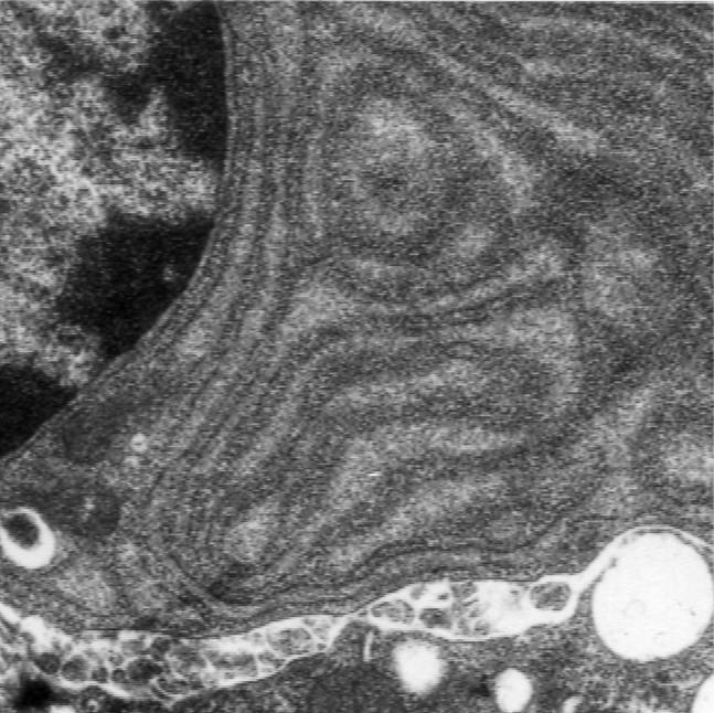Tejido conjuntivo común: Células inmigrantes El microscopio electrónico de transmisión permite apreciar en el citoplasma de