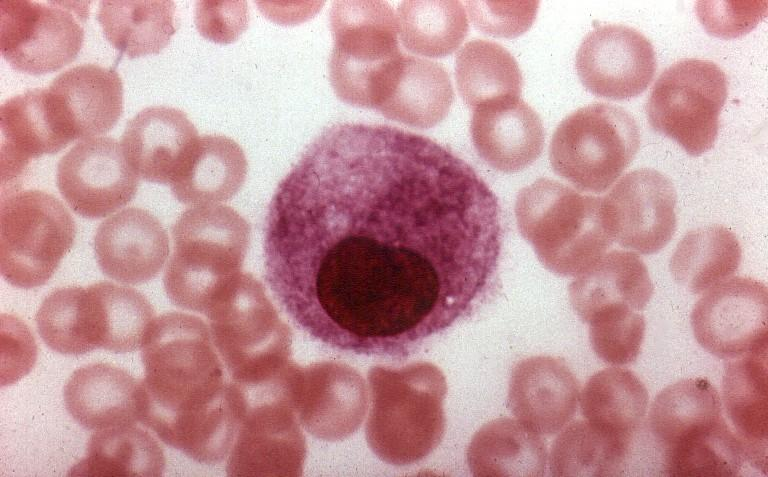 Tejido conjuntivo común: Células inmigrantes Los macrófagos son células muy grandes.