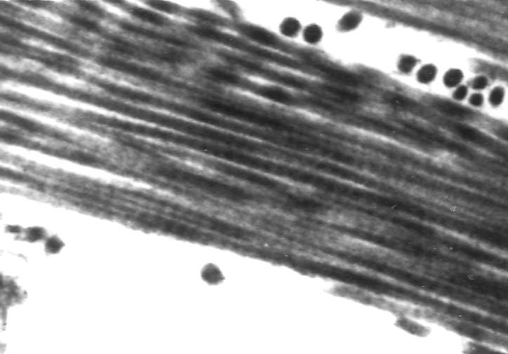 El aspecto de las fibras de colágena con microscopio electrónico