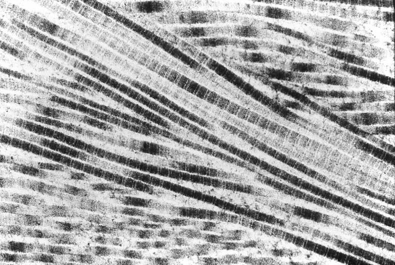 Fibras de colágena con microscopio electrónico de transmisión.