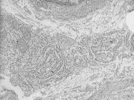 Tejido conjuntivo común: Células propias En este caso el citoplasma del fibroblasto muestra por medio