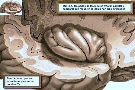 Cerebro Lóbulo Frontal: Movimientos voluntarios y lenguaje verbal y escrito. Lóbulo Parietal: recepción sensitiva de dolor, tacto, temperatura, distancias, tamaños y formas.