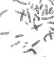 70 Resultados m n m ñ o Figura 4.7d. Resultados de la hibridación in situ utilizando las sondas de los cromosomas 13, 14, 15 y 16 humanos en CAP.