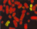 72 Resultados u v Figura 4.7. Resultados de la hibridación in situ utilizando las sondas de los cromosomas 22 y X humanos en CAP. u) La sonda de 22 HSA hibrida en el par cromosómico 25 () de CAP.