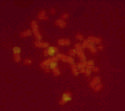 Resultados 81 a b c d Figura 4.10a. Resultados de la hibridación in situ utilizando las sondas de los cromosomas 1, 2, 3, y 4 humanos en ABH.