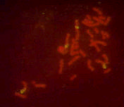 Resultados 83 h i j k Figura 4.10c. Resultados de la hibridación in situ utilizando las sondas de los cromosomas 8, 9, 10 y 11 humanos en ABH.