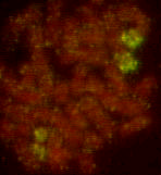 84 Resultados l m n ñ Figura 4.10d. Resultados de la hibridación in situ utilizando las sondas de los cromosomas 12, 13, 14 y 15 humanos en ABH.