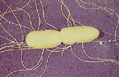 BACTERIAS GRAM NEGATIVAS Enterobacteriaceae