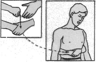 Si el paciente está consciente: Animar al paciente a toser Dar cinco golpes interescapulares, con la victima inclinada hacia delante Si no se ha resuelto, aplicar la maniobra de Heimlich.