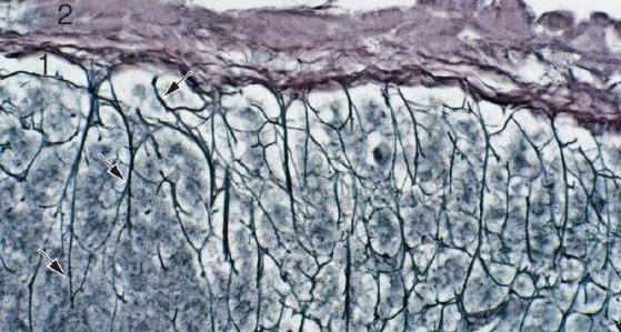 Aspecto microscópico de las cápsulas y el retículo fibrocelular subcapsular de órganos parenquimatosos.
