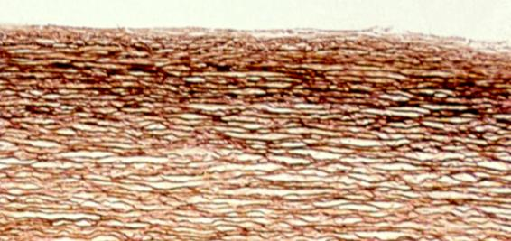 Estas membranas integran las membranas basales de todos los epitelios, la denominada cápsula del cristalino; la membrana que se adhiere al sarcolema de las fibras musculares y la