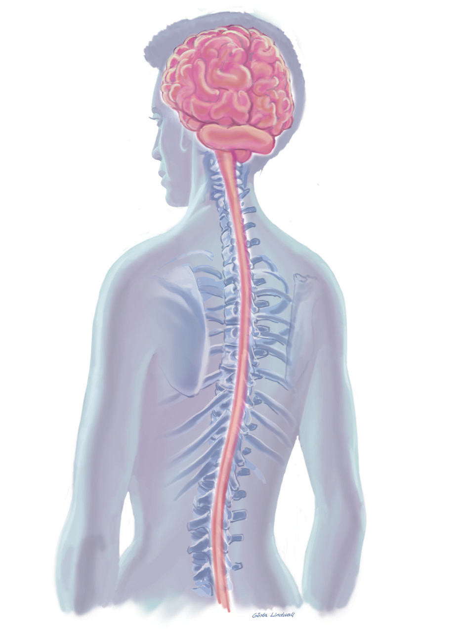 En la EM, se producen pequeñas inflamaciones en el cerebro o la médula espinal. Esto daña a la mielina, provocando que se descomponga.