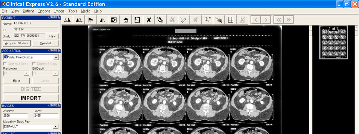 Software DICOM de adquisición de película VIDAR Clinical Express Radiografía general y mamografía ClinicalExpress se ha diseñado para facilitar el funcionamiento, además de haber sido desarrollado