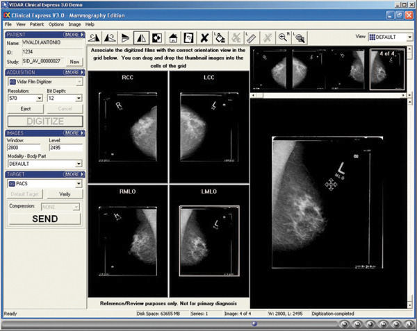 imágenes al archivo PACS, a la estación de trabajo para la lectura de los mamogramas o a otras estaciones de trabajo que cumplan los requisitos DICOM.