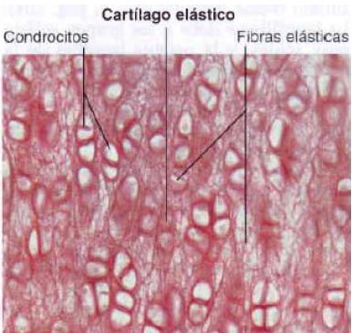 condrocitos y abundantes fibras