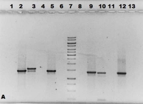 Se utilizó un kit comercial (Jena Biosciense) para purificar el DNA plasmídico extraído previamente, se seleccionaron las clonas con patrones distintos en la doble digestión.