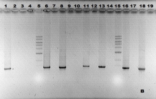 El DNA fue diluido a una concentración de 50 ng/!l en un volumen de 50!l para que posteriormente fuera secuenciado. Secuenciación de DNA.