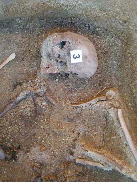 Informe de exhumación de fosa común en Casavieja (Ávila) Marzo de 2009 INDIVIDUO 03 39 Descripción Individuo en decúbito supino extendido. El esplacnocráneo se halla totalmente fragmentado.