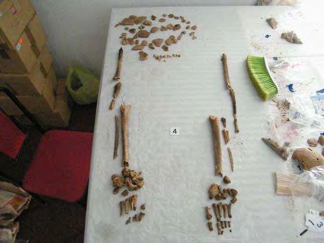 Informe de exhumación de fosa común en Casavieja (Ávila) Marzo de 2009 Estudio antropológico 46 Grado de conservación del material óseo muy deficiente.