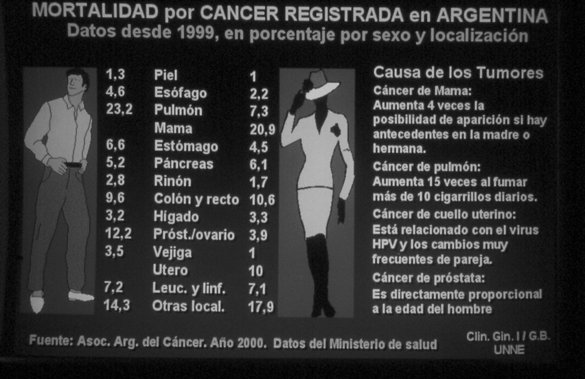 Ca de Cuello de Utero El cáncer cérvico-uterino (CCU) es la lesión maligna, del aparato genital femenino, más frecuente en América Latina y el Caribe, se calcula que en la región de las Américas se