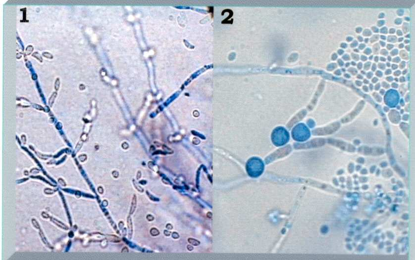 albicans o dubliniensis -Micromorfología en AHM a-blastoconidios y/o pseudomicelio