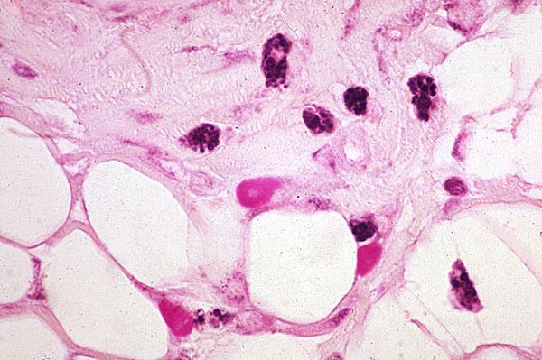 macrófagos Células cebadas