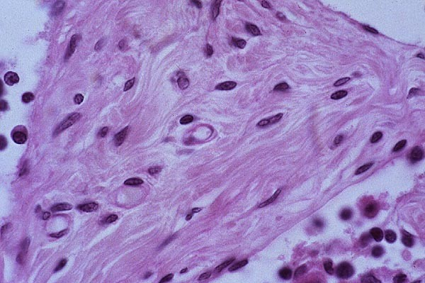 Fibras colágenas Fibroblastos