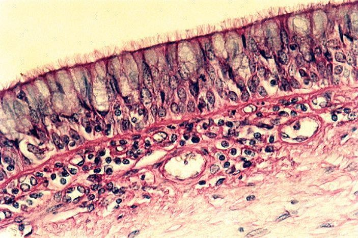 Epitelio simple (pseudoestratificado) de células poliédricas ciliadas Tráquea (epitelio