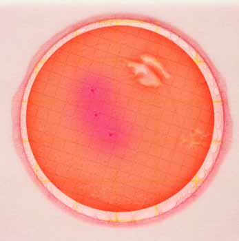 burbujas de gas que rodean el filtro no indican crecimiento microbiano. Observe el círculo como ejemplo.