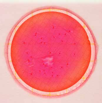 gas afectan la morfología de las colonias: Coliforme distorsionado por burbuja de gas (círculo A ); colonia