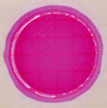 Observación: Las enterobacterias se identifican por la presencia de ácido (halo amarillo) o por las burbujas de gas
