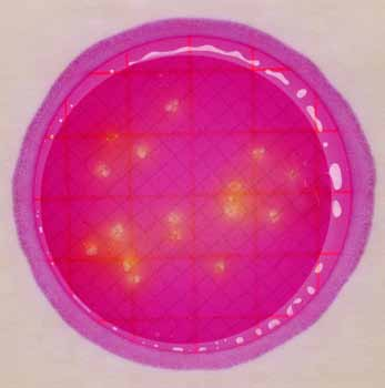 3 Figura 3 Placa para enterobacterias con alto recuento Recuento: 17 cfu Observación: Las colonias de color rojo sin