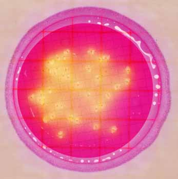 Figura 4 Placa para enterobacterias con alto recuento Recuento: 43 cfu Observación: El color de la colonia puede