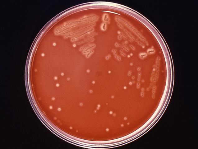 Streptococcus pyogenes.