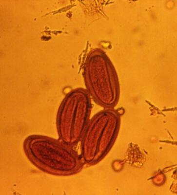 vermicularis, M en C Aurora Candil/UNAM Adulto de T.