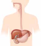 Hígado Cálculos biliares Vesícula Conducto biliar Estómago Estenosis Duodeno Abertura del conducto biliar Páncreas Pancreatitis Cuando se bloquea el conducto biliar, la bilis no puede