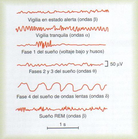 CAMBIOS DEL EEG EN DIFERENTES FASES DE LA VIGILIA Y EL SUEÑO V ondas b baja frecuencia. sueño muy ligero. Voltaje bajo interrumpido ráfagas de ondas a (husos del sueño).