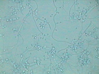 14 Células conidiogenas en 100x Botritys cinerea SN 114 Cladosporium cladosporioides SPG 38 Conidioforo ramificado en