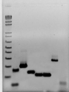 b Rastreo de colonias recombinantes por PCR. Los fragmentos amplificados por RT-PCR fueron insertados en el vector pgemt y utilizados para transformar bacterias E.coli.