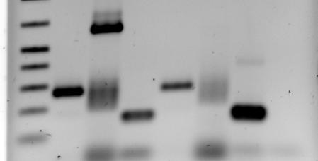 El ARN extraído del extracto inicial (In) y del inmunoprecipitado con anti diskerina (IP) se transcribió y amplificó por PCR con iniciadores específicos para cada ARN.