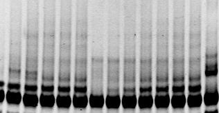 Densidad Integrada los dos oligos tuvo efecto sobre la actividad telomerasa humana, lo que demuestra que el efecto inhibitorio del oligo AS1 es específico para la actividad telomerasa de P.