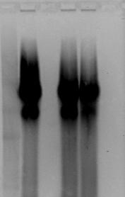 fragmento de 7557 pb (tamaño esperado) no era posible, con las enzimas convencionales utilizadas en RT-PCR.